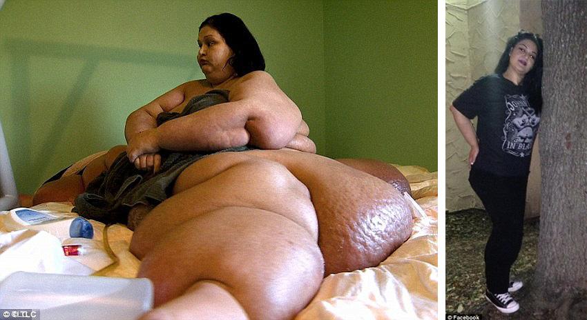 Image result for World’s Fattest Woman Who Lost Over 800 Pounds And Looks Absolutely Amazing Now