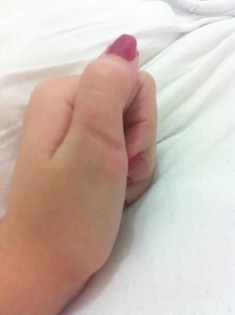 nottodaymari's tweet photo. bem massa ser canhota e ter que usar tesoura de destro e ficar com essa marca no dedo :-) http://t.co/YCJ7lI83hE