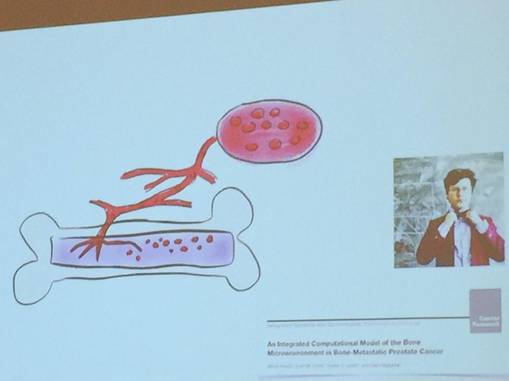 ara_anderson's tweet image. Moffitt ICBP @dbasanta An integrated framework to test treatments in bone metastatic prostate cancer #icbppsocmath