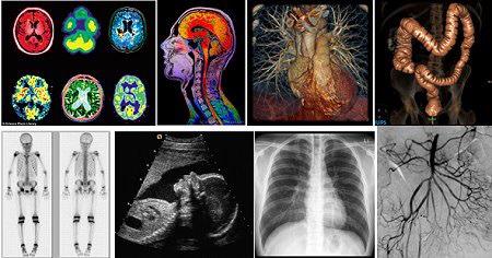 Garry Choy, MD MBA (@garrychoy) on Twitter photo “@ElieBalesh: Radiologists see things in you other people can't. #SIR15ATL #IRad #JVIR #visiontoheal ” “@ElieBalesh: Radiologists see things in you other people can't. #SIR15ATL #IRad #JVIR #visiontoheal ”