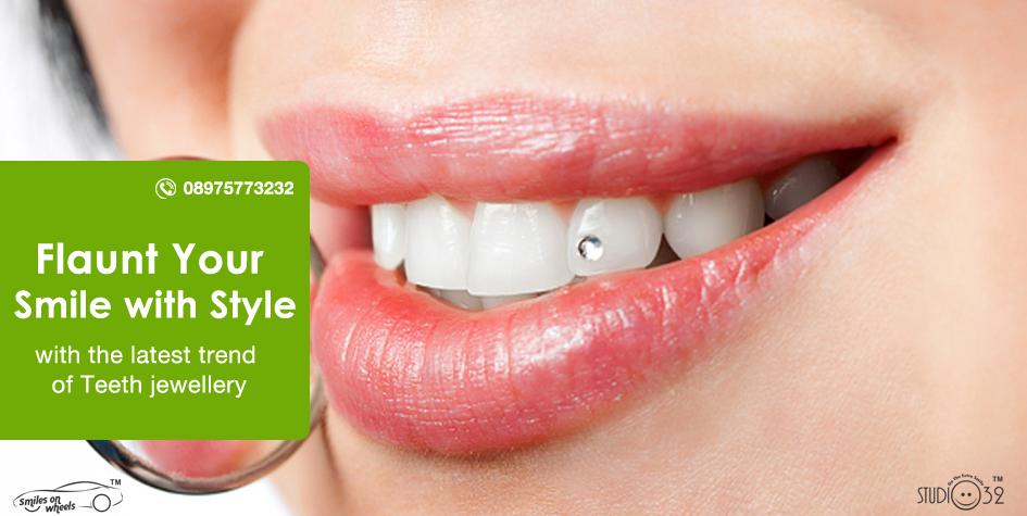 Flaunt your smile with style with the latest trend of #TeethJewellery.

#SmilesOnWheels #Goa