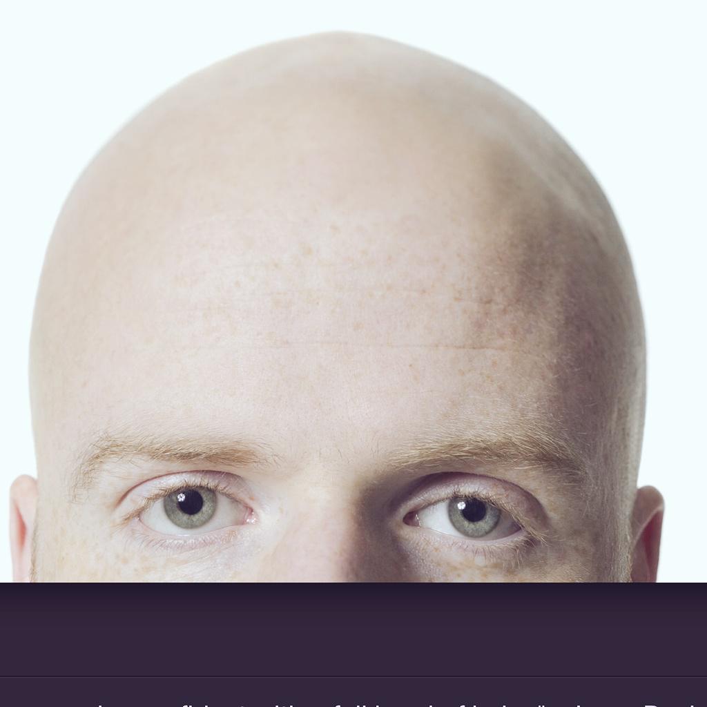 OliviaWeidert's tweet photo. If this gets 300 retweets by Thursday I get to shave @AlbinoRhino0 head! RETWEET IT! #BaldAlbino #HelpAGirlOut ✂️👻🐁 http://t.co/RmtxGsrRe1