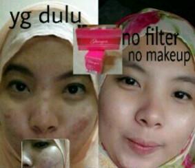 Cantik with Moment #moment #momentglucogen #glucogen