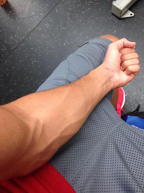 Veiny why arms do people have Why Do