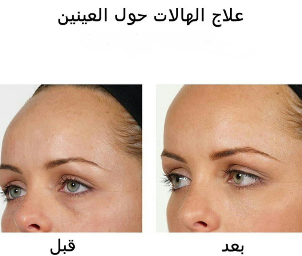 neoderma_jeddah's tweet image. 