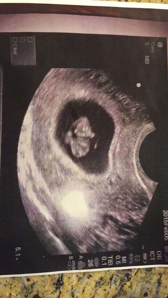 daisyd___'s tweet photo. loving my wittle peanut so much alreadyβ€οΈπΆ #septemberhurry #thisisnotmine http://t.co/ielNRUlRTw
