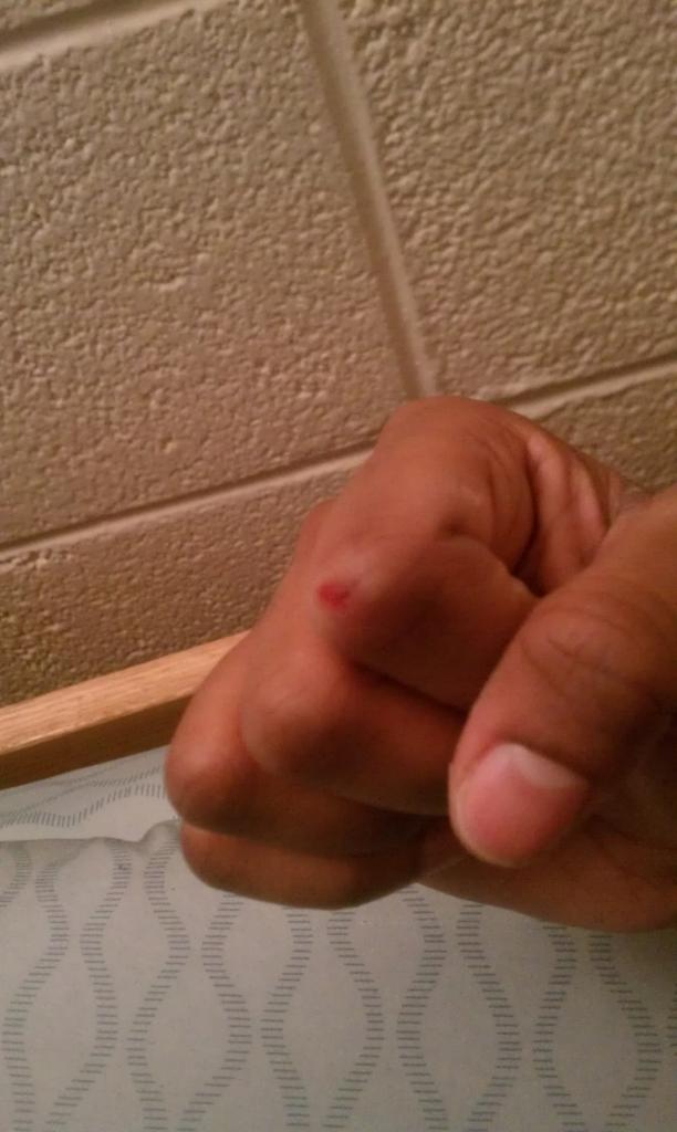 Tijo_'s tweet image. Sanded the fuck out my knuckle tonight.. #3DClass #WoodTools