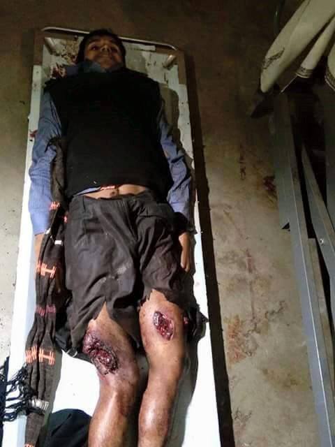 RKzayed's tweet photo. @dailystarnews what kind of support??? example.. #stepdownhasina #SupportZia #StopExtraJudicialKillings @hrw @eu_eeas http://t.co/CtlGWKDVfk