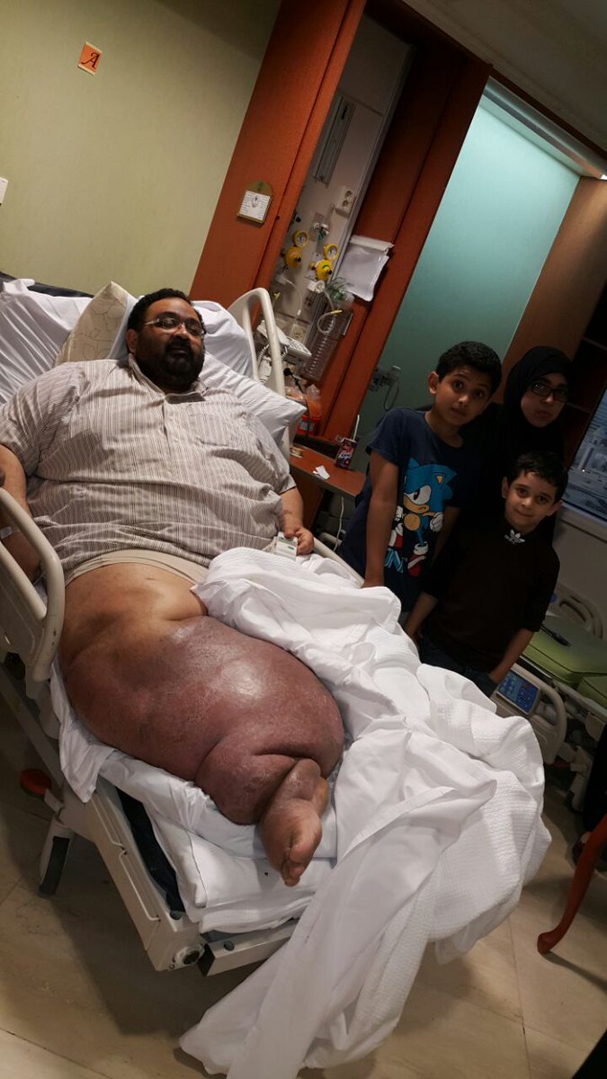 z7sa1's tweet photo. الى وزير الدفاع ورئيس الديوان الملكي / اناشدك بالله المساعة في علاجي بالخارج  لم يجد الاطباء حل لمشكلتي من داء الفيل http://t.co/dgqjPg7bgC