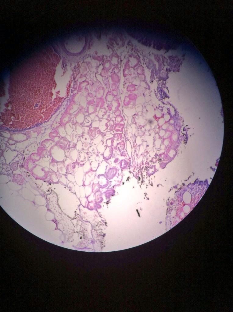 claumartnez's tweet image. Necrosis grasa. #DeLibro #Pato