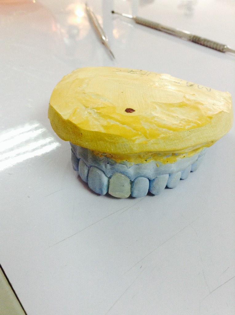 katskidoodless's tweet photo. Oral Anatomy gaming. Wala na akong skills sa pagccarve. HAHAHAHA #waxPattern #Prostho http://t.co/aQNknhf3H5