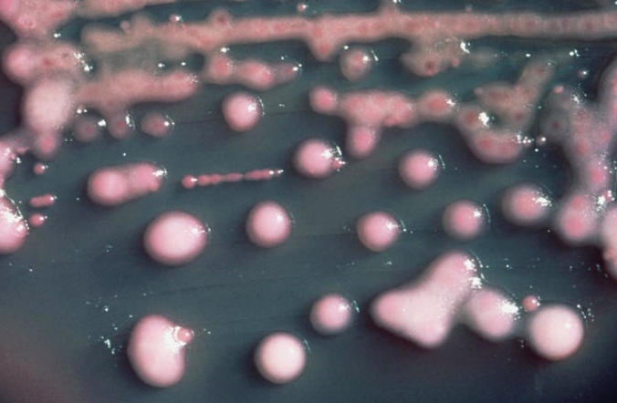Spadaque's tweet image. Nxt yr's hot new trend. Let's all get it! "@CBSNews: 15 "superbugs" and other scary diseases: cbsn.ws/17AXDuV http://t.co/AQ04LGazTj"