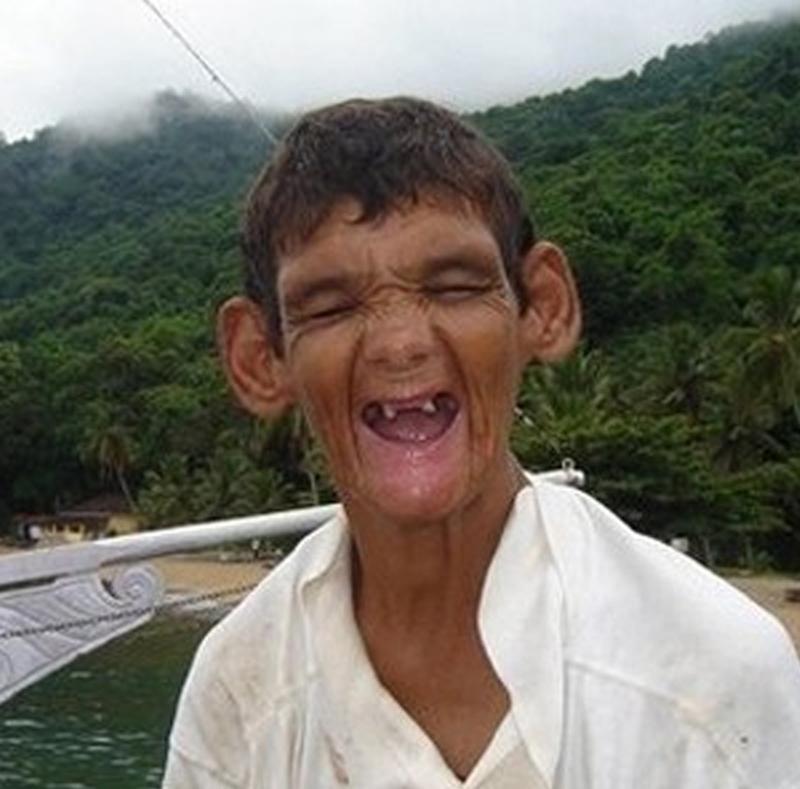 The Most Ugly Person In The World