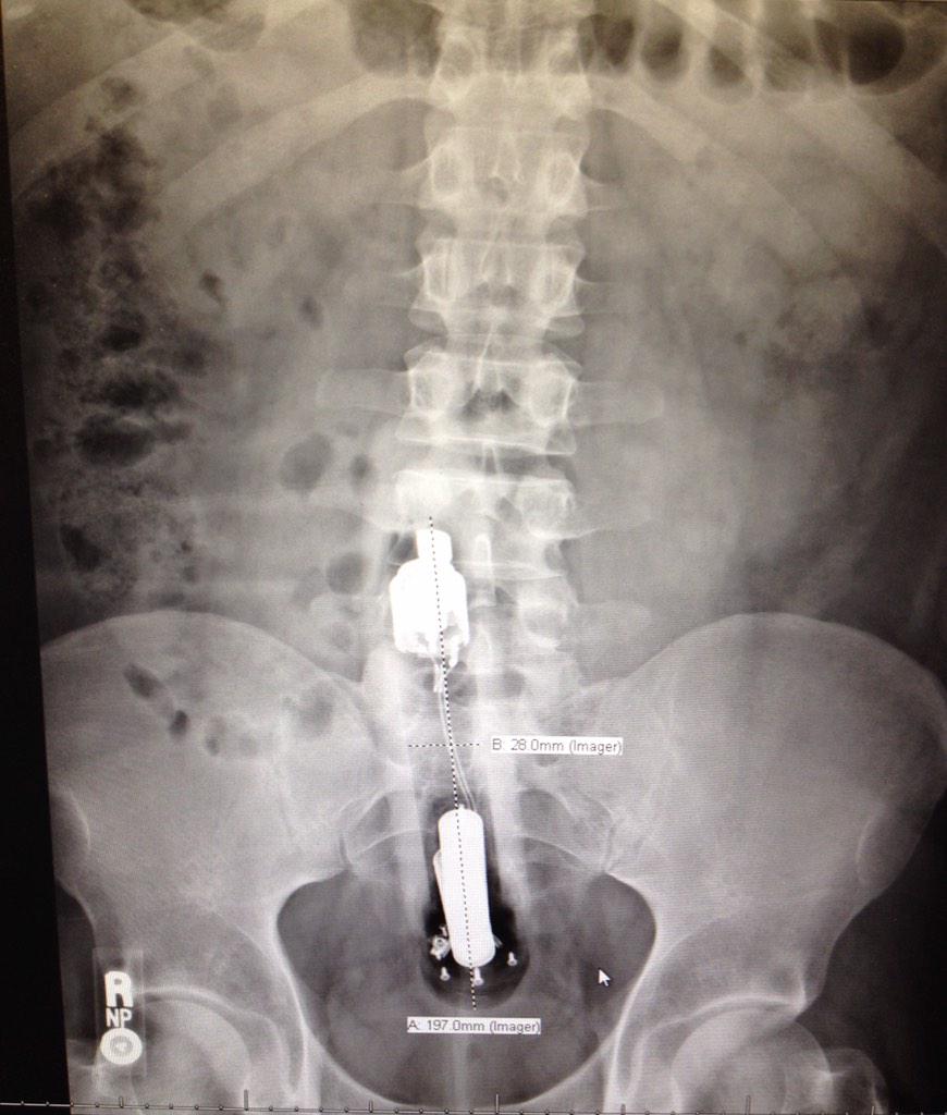 ER_glitter's tweet image. Let's play a game... Name that object!
#ERProblems