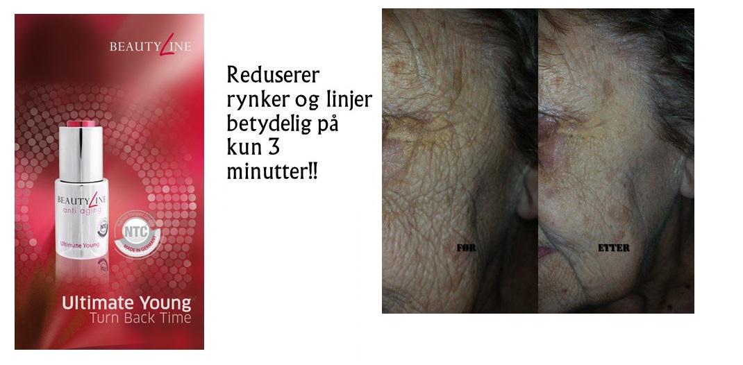 BodyShapeCliniq's tweet photo. Wrinkles gone in 3 minuts! #UltimateYoung #PartyFix http://t.co/QcOxGMAE7n