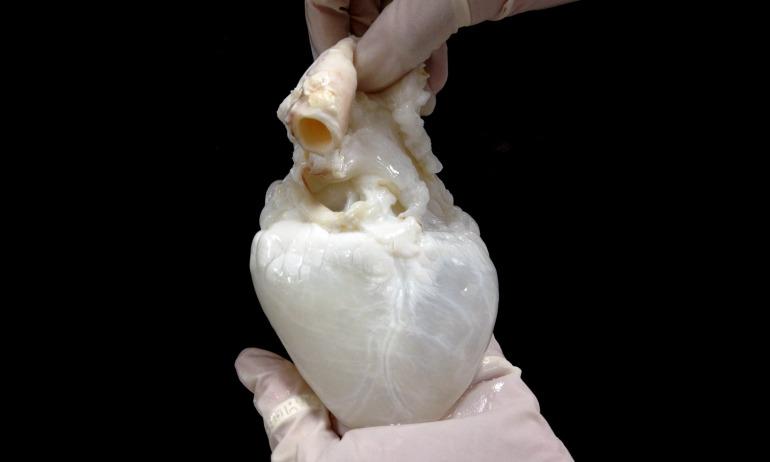 TEDTalks's tweet image. This is a ghost heart that may one day become a personalized human heart: t.ted.com/hk7tY5E