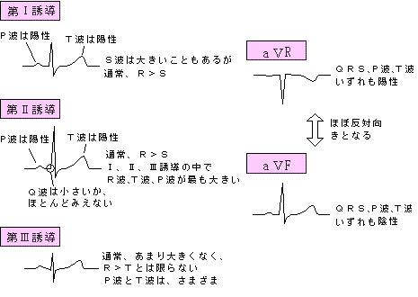 【心電図の正常波形】