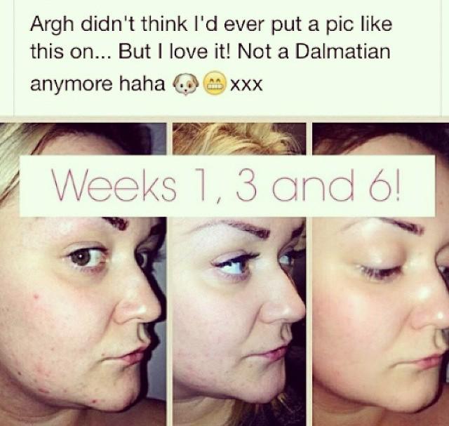 healthy_tania's tweet photo. @ItsJustSophiee Using our Premium Capsules helps clear skin 😊 http://t.co/T4I3gMubwG