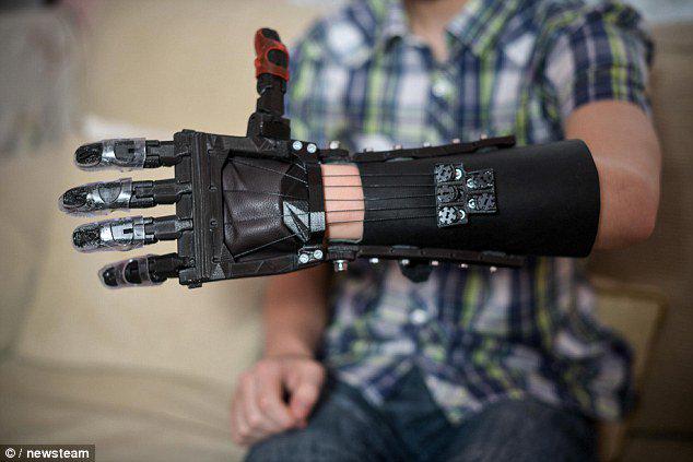 3DPrintGirl's tweet photo. 15-year-old Star Wars Fan Receives Darth Vader-esque 3D Printed Prosthetic Hand http://t.co/2IHvdIp718 http://t.co/UzYEF4K0lN