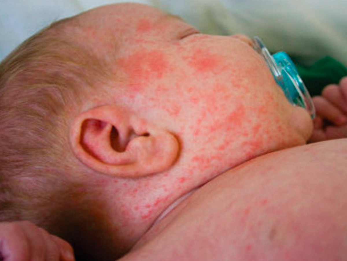 mwhitegateway's tweet photo. Want this? If not, get vaccinated. #ghscivics #DoNowVaccinate
http://t.co/2wTrkzcjnB http://t.co/2T0O1Avve5