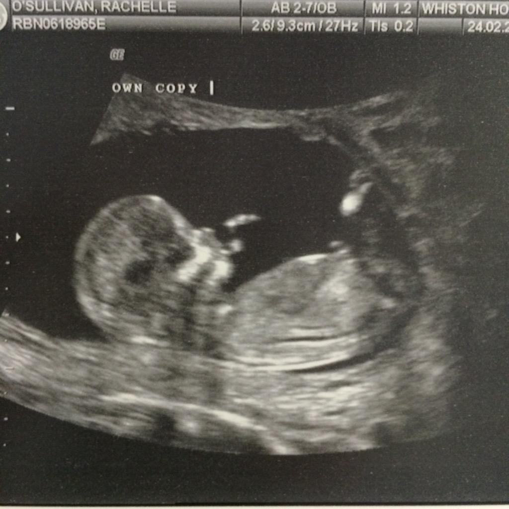 KIDDA001's tweet image. My new addition to the family!!! #babyno2 #happy #family