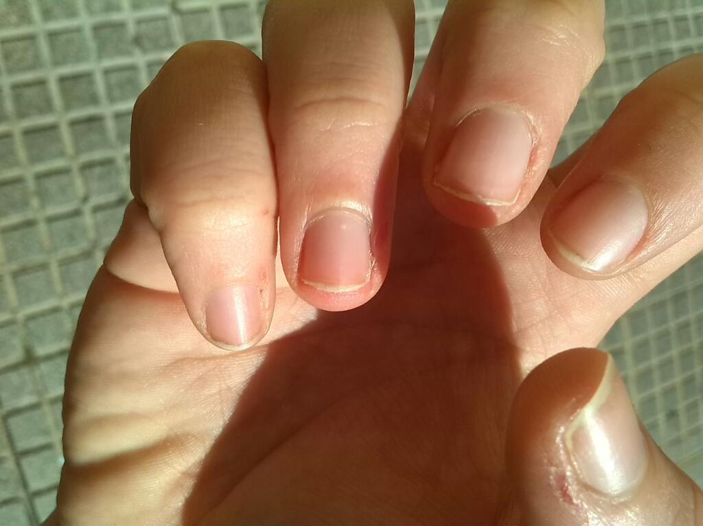 MichaelisaFF's tweet photo. Foto 1: Días sin clase.
Foto 2: Primer día de clase. http://t.co/Tqx7fq31dL