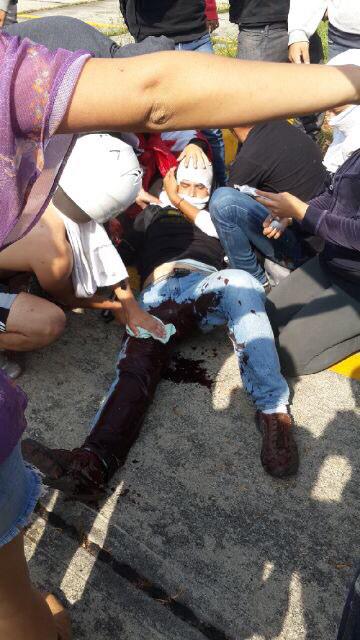 RConfidencial's tweet photo. PERIODISTA  @omargonzalez6: Sigue criminal represión  . Otros 3 heridos de bala en la ULA #25F   http://t.co/ZHRnbZwnGr