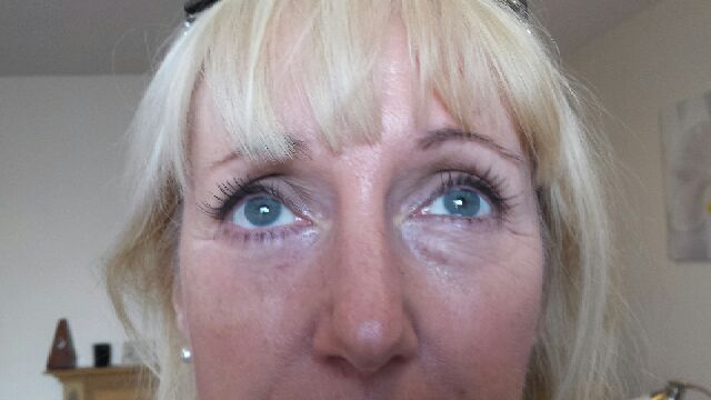 lipo_wave's tweet photo. Another spot the difference with Instantly Ageless! #northeasthour #NEFollowers http://t.co/JHcVwNwvFM