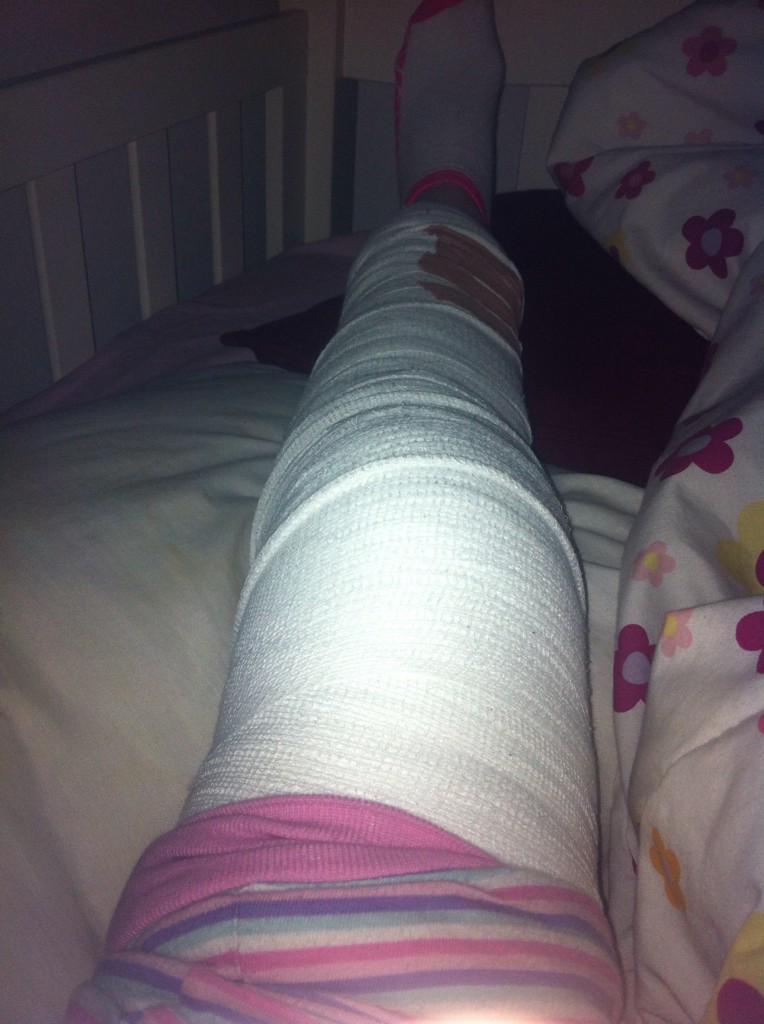 jessmess2000's tweet photo. @mackzmusicinc @maddieziegler@dancemom1313 WILL YOU SIGN MY CAST AT THE DUBLIN SHOWCASE TOMORROW??🍀😋💋 http://t.co/gOfCZguQSo