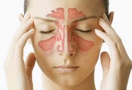 ProConsumidorRD's tweet photo. #NotiConsumo Sinusitis: un problema que afecta a muchos:➔ http://t.co/aB6FUi516W http://t.co/kmJgTAAod6