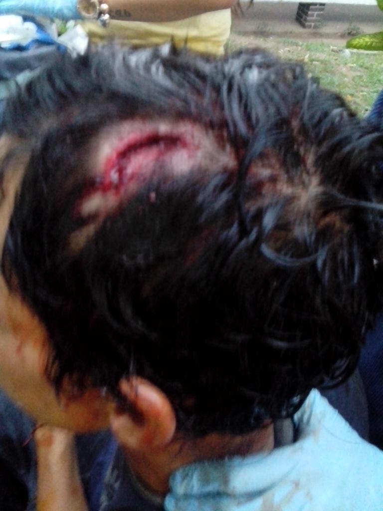 1954candanga's tweet photo. "@9soro: @el_pais LA GNB SECUESTRÓ LA AMBULANCIA Y NO DEJAN SALIR A LOS MUCHACHOS HERIDOS #TÁCHIRA http://t.co/vD5UDFXgtc" @ResistenciaVZ"