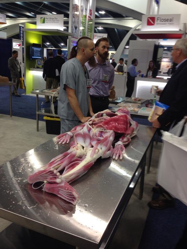 LairdH's tweet photo. Remember "Operation," that 1970s surgery game? Surgeons have a more sophisticated version now. #ACS2014 http://t.co/obSqZJFxlw