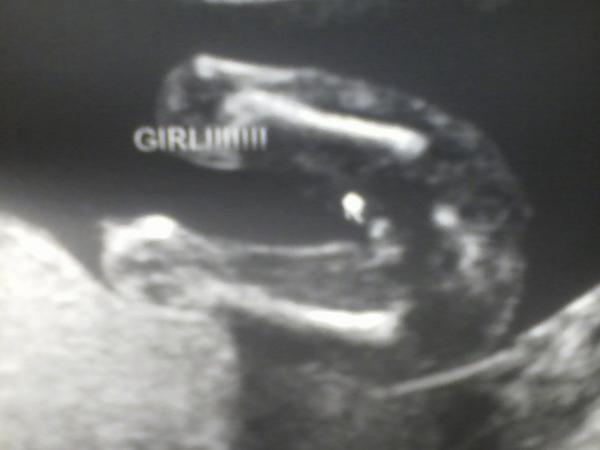 MissKathyMODEL's tweet photo. Baby #2 is a Girl <3 http://t.co/mbgWGMzcXx