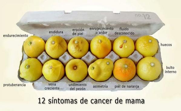 APyCitologia's tweet photo. 12 síntomas de cáncer de mama @drcarlosrepetto http://t.co/l40q3wruh3