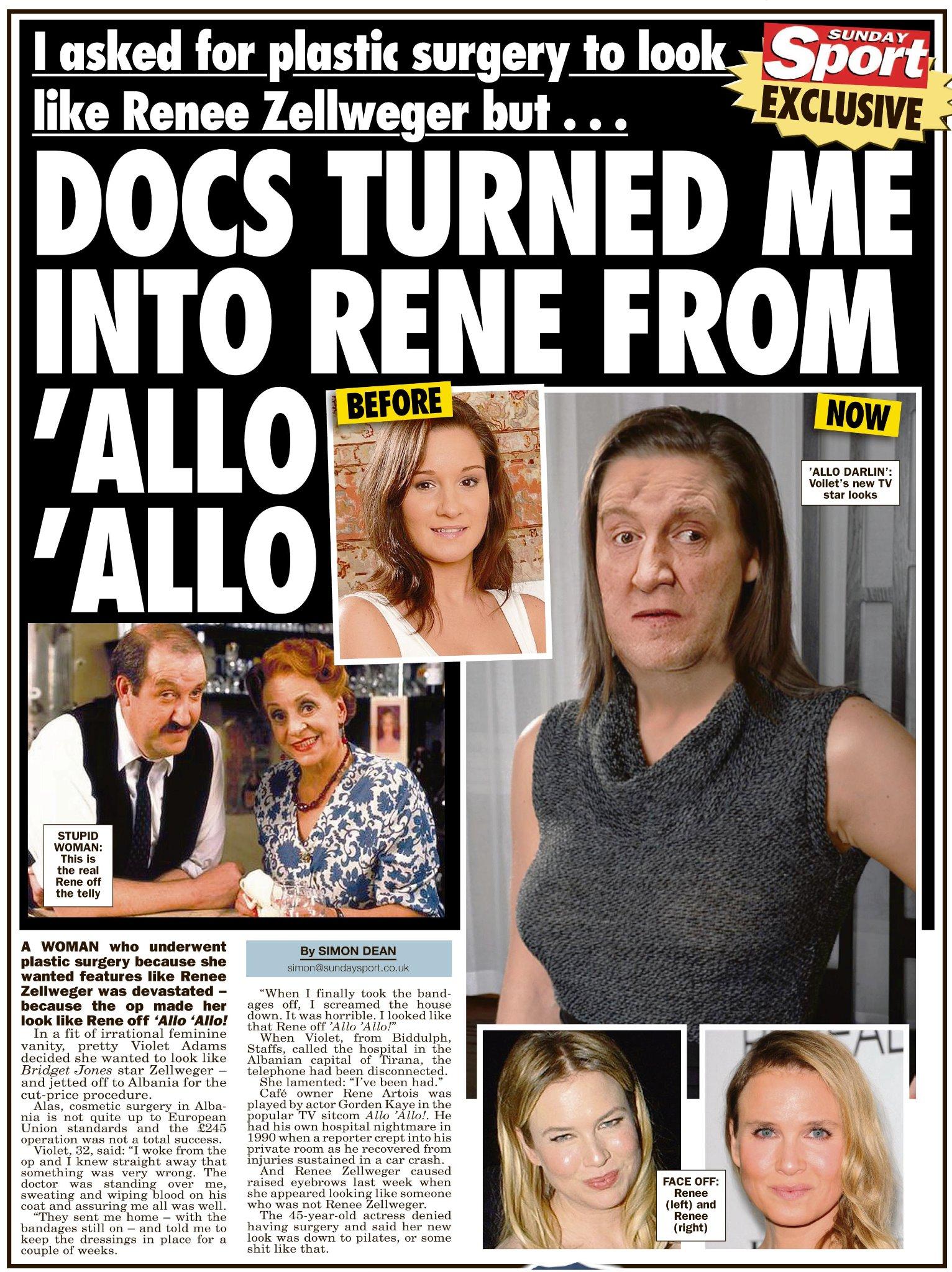 Sunday Sport Plastic Surgery Hell I Wanted The Renee Zellweger Look But Now I M More Like Rene From Allo Allo Http T Co Eldutgookw Twitter
