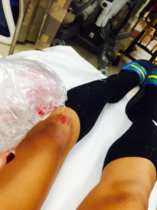 Elenaroo's tweet image. Goalie career was short lived #dislocated