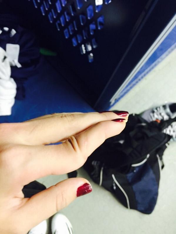 Elenaroo's tweet image. Goalie career was short lived #dislocated