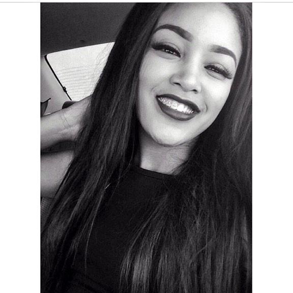 GooodsD's tweet photo. Braces 😬 http://t.co/vNTO3UnGqX