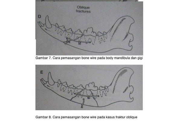 satwakita's tweet photo. Contoh-contoh cara pemasangan bone wire. #FSM (sumber : dokumen IPB) http://t.co/YaHwcS5Fph