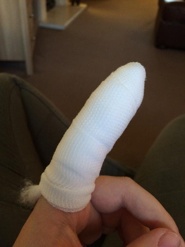 _beckyodonnell's tweet photo. 9:30am and I've already broke my finger, good start to the day👍 http://t.co/OX9Cxpd4UK