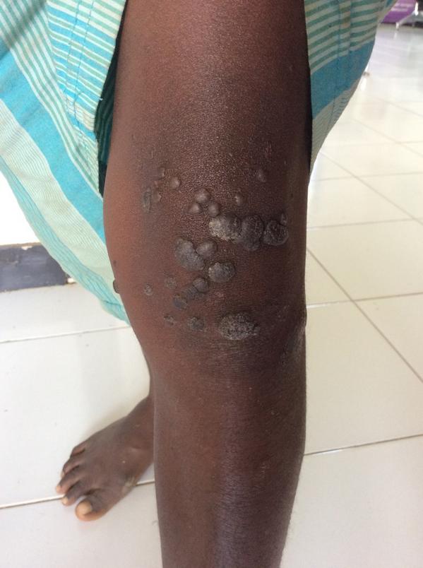 soalUKDI's tweet photo. Diagnosis? http://t.co/Fxobs3VDq5