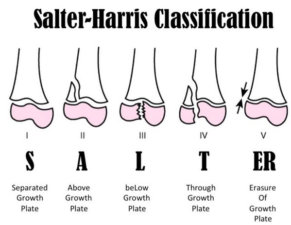 Формулы для расчета калорий и бжу. Уровни харриса. Уровни активности для расчета калорий. Высший уровень управления. Уровни харриса.