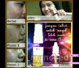 Propolis &amp; biyyang ,soluse sehat ,awet muda more info 08994405005 pin : 26677390 <a href="/iklan_OKE/">iklan OKE</a> <a href="/apaajaIKLAN/">apaajaIKLAN</a> @iklaniaku