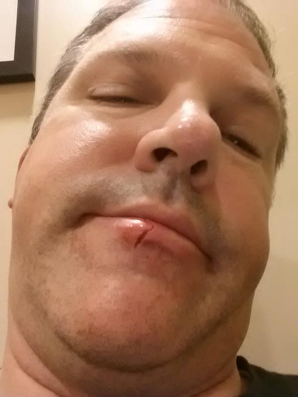 CoachTous's tweet photo. Hey @BradFrey1 so how was your day? #WhenDogsAttack #AnybodyWantADog http://t.co/7etiikBtNy