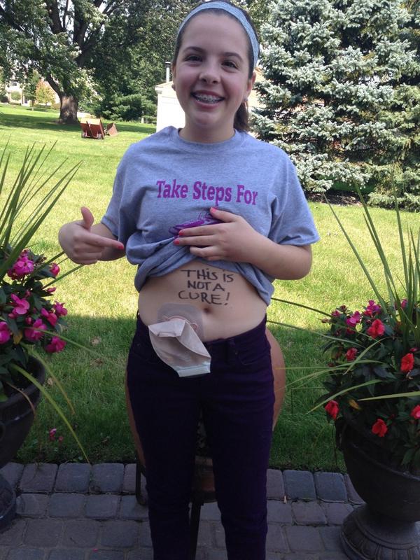 ibd_awareness's tweet photo. Don't let anything stop you from being you #cureibd #thisisnotacure #ibd #crohns #colitis http://t.co/l80L1LeAlS