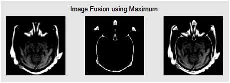 pantechsolution's tweet image. #Matlabcode for #PixelLevelImageFusion using #MaximumMethod.
&amp;gt;&amp;gt;bit.ly/1jTiwHR
