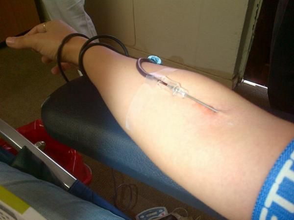 RugberM's tweet photo. I did my good deed 2day....ouch!!! What did u do? http://t.co/YFnGp74JRK