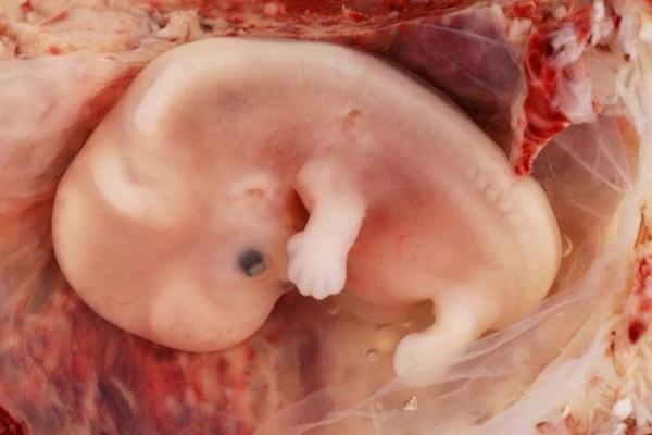 Embarazoo's tweet photo. 7 Semanas de embarazo | Desarrollo y síntomas en este artículo ~>http://t.co/xYUTjTpmyI ¡Tu embarazo semana a semana! http://t.co/DtSIROCWqz