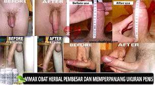 AlatBantu_69's tweet photo. #PembesarPenis
#SextoysPria
#SextoysWanita
#ObatKuat
#PerangsangWanita
PIN:7EE35F67
LINE:linksextoys
HUB:081293333433 http://t.co/15ch8Cu94j