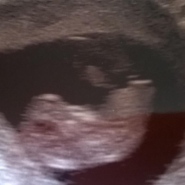 lisa marie rye (@Lmr83Rye) | Twitter